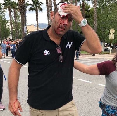 Catalogna, referendum macchiato dal sangue: 761 feriti. "Rajoy si dimetta"