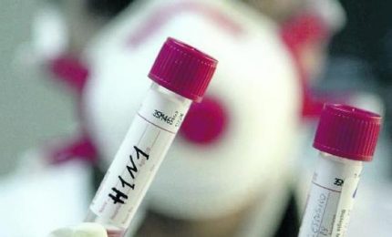 Influenza suina a Enna con due ricoveri