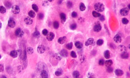 Dalla Calabria la speranza di un farmaco per bloccare il Coronavirus