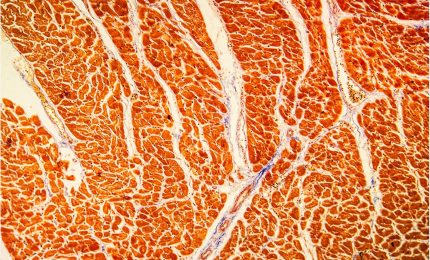 Vaccini anti-Covid, miocardite, pericardite: un po' no, un po' s&igrave;. Mah...