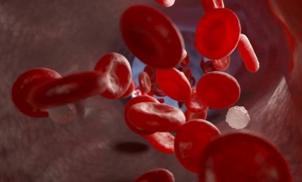 Beta-Talassemia, nuova molecola riduce la necessit&agrave; di sangue