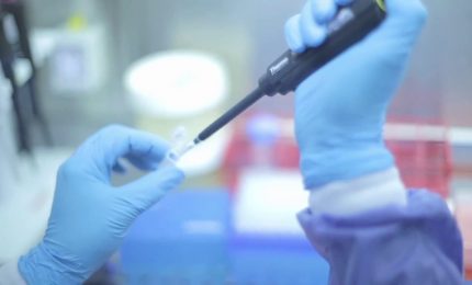 Leucemia mieloide, la speranza da cellule terapeutiche pi&ugrave; potenti