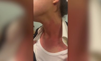 Norme pi&ugrave; dure contro la violenza negli ospedali