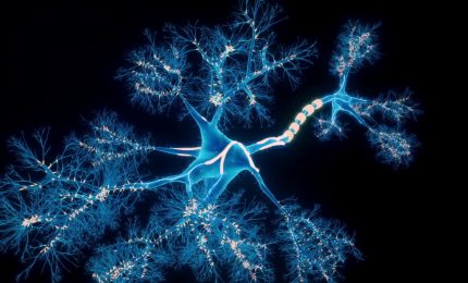 185 mila persone colpite da ictus ogni anno in Italia