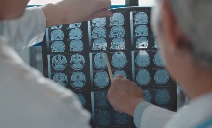 Alzheimer, terapie allo studio per rallentare il decorso