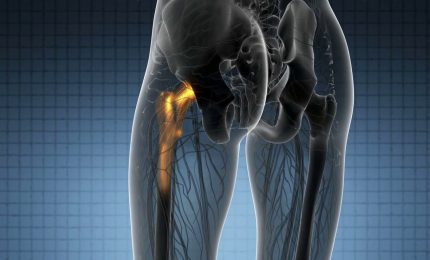 Bioaction, progetto Ue contro infezioni associate alle protesi