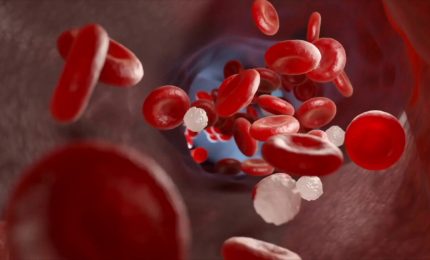 Trombosi, ecco quali sono i sintomi da non trascurare