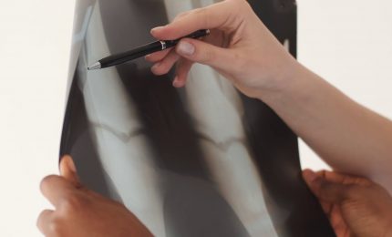 Protesi del ginocchio, recupero post-operatorio sempre pi&ugrave; rapido