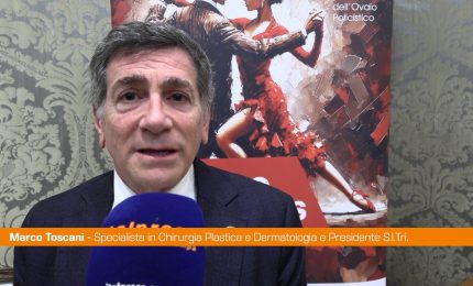 PCOS, Toscani "Acne e alopecia segni clinici principali"