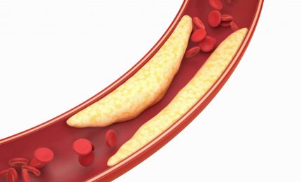 Malattie rare, un ricettario per la lipodistrofia