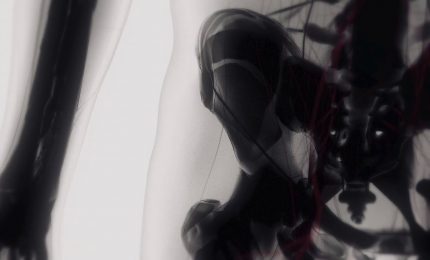 In aumento interventi di protesi d&rsquo;anca anche per i pi&ugrave; giovani