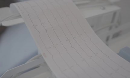 Amiloidosi cardiaca, istituito un gruppo di lavoro