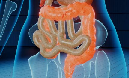 Colite ulcerosa, autorizzata la rimborsabilit&agrave; per etrasimod