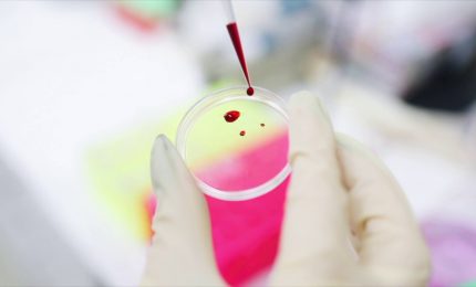 HIV, nuove conferme su terapie e profilassi long-acting