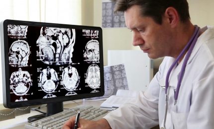 Epilessia, una malattia dalle varie forme