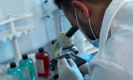 Un "interruttore" molecolare frena la progressione del cancro