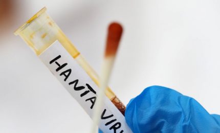 Hantavirus, negativa la paziente argentina ricoverata al Policlinico di Messina
