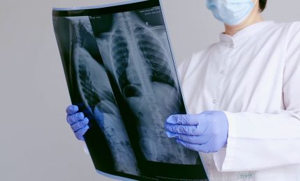 Tumori rari, i sarcomi richiedono diagnosi tempestive e alta specializzazione